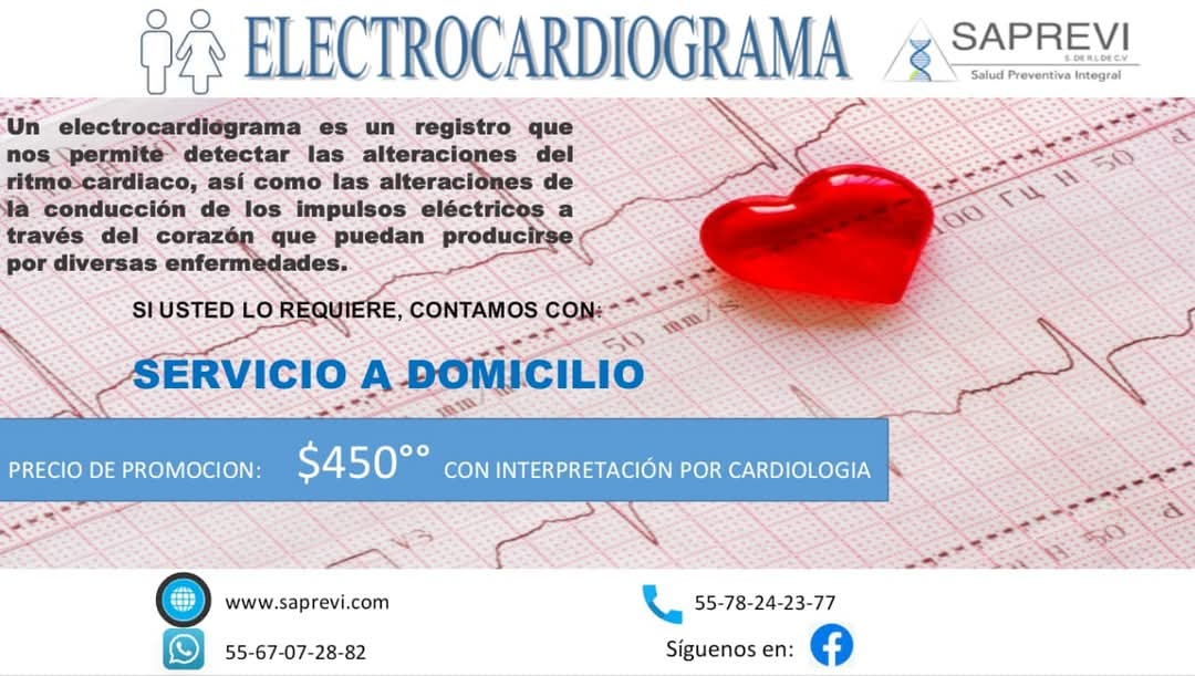 Electrocardiograma a Domicilio